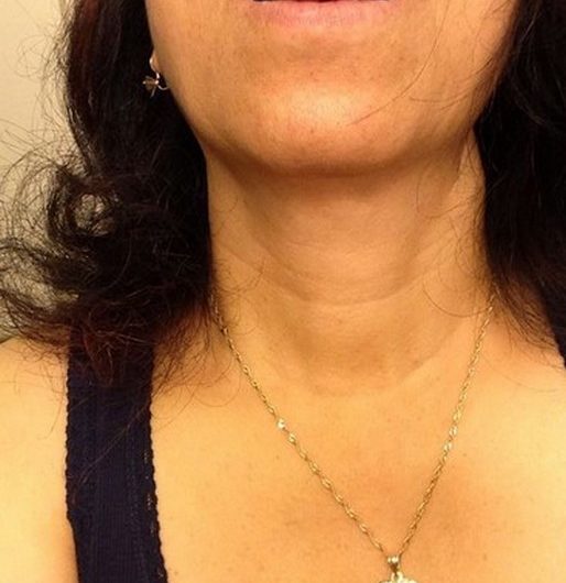 Joyce divorcée ch un coup d’un soir sur Mulhouse